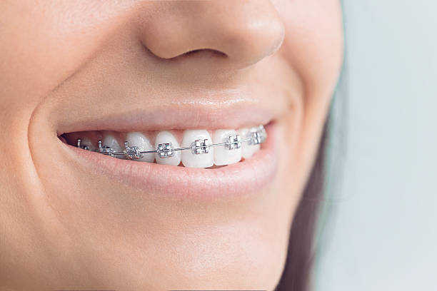 Best Dental Bonding  in Carmi, IL
